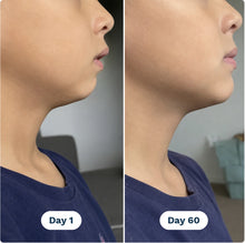 Jaw and neck line in profile, day 1 and day 60
